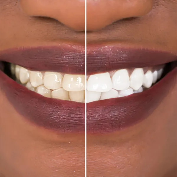 32645 glebe dentist consultation