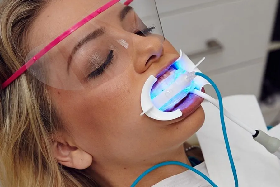 32645 professional teeth whitening glebe