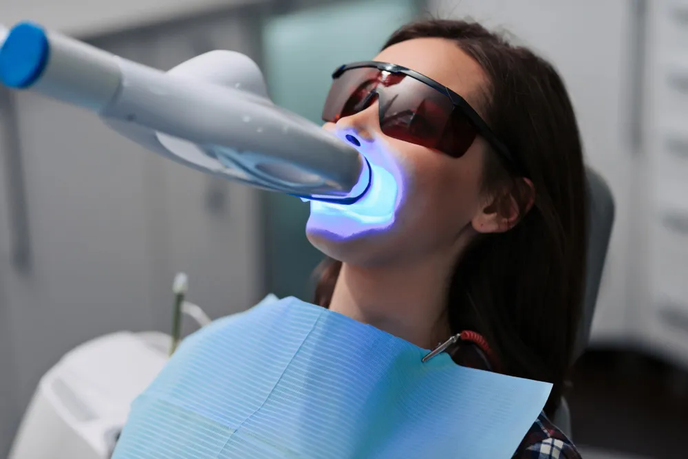 32649 teeth whitening okc take home