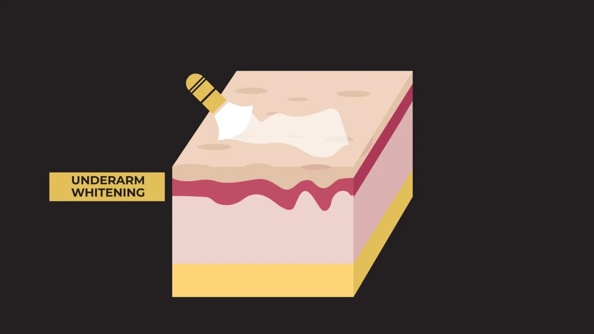 32650 microdermabrasion calgary