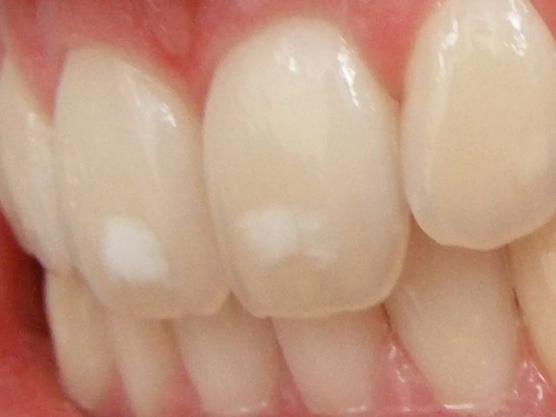 /img/32666-healthy-teeth.webp