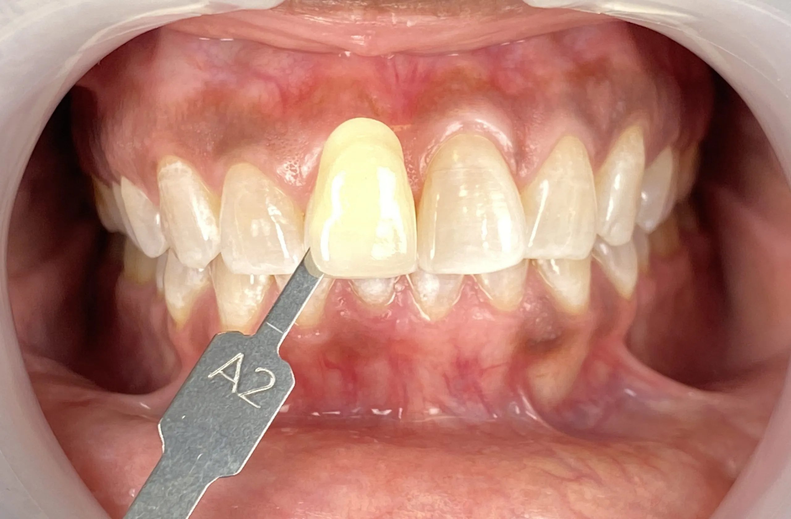 32670 dentist stratford