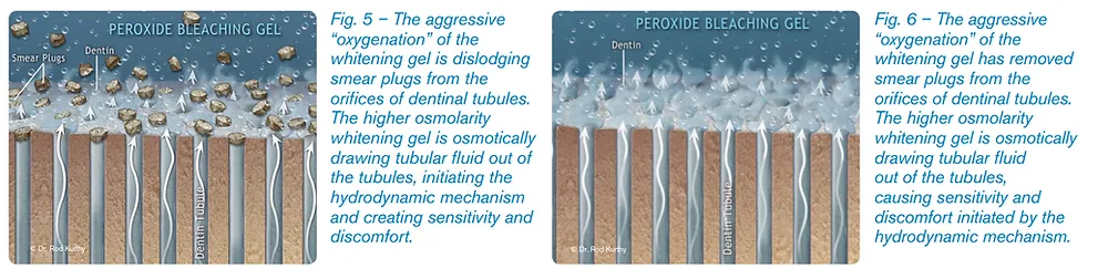 32672 fluoride treatment