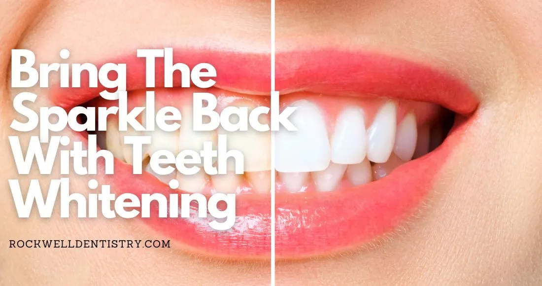 32691 teeth whitening sudbury checkup