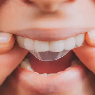 /img/32710-professional-teeth-whitening.webp