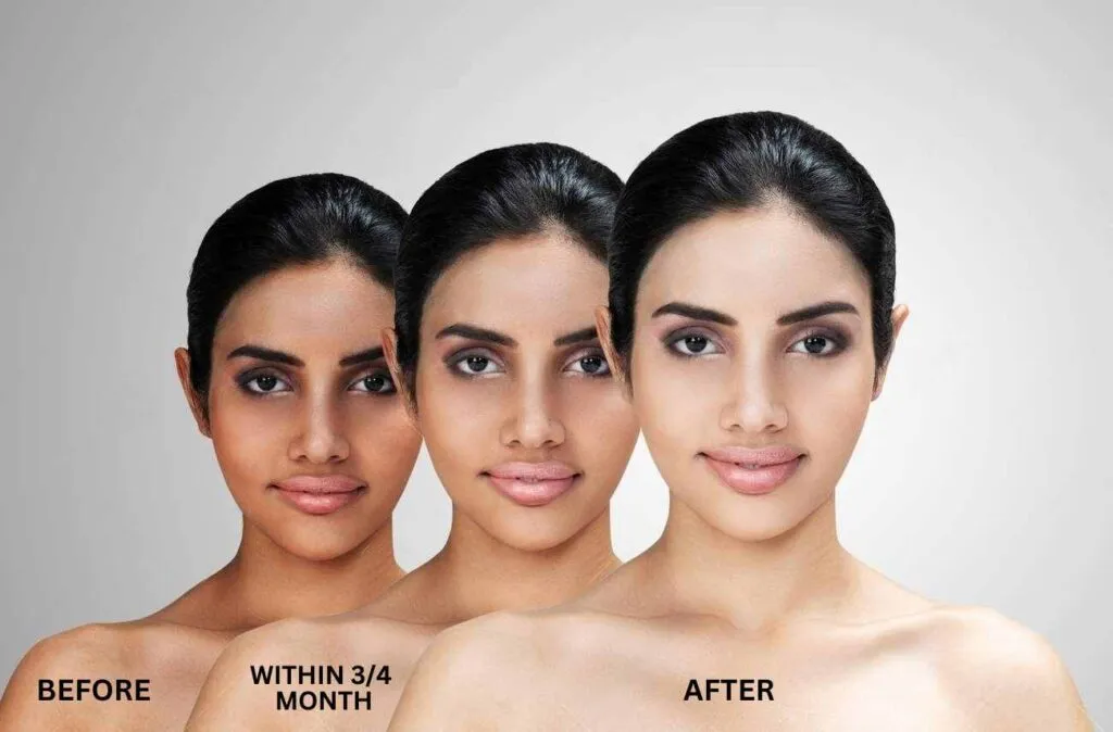 32713 skin whitening cochin 2