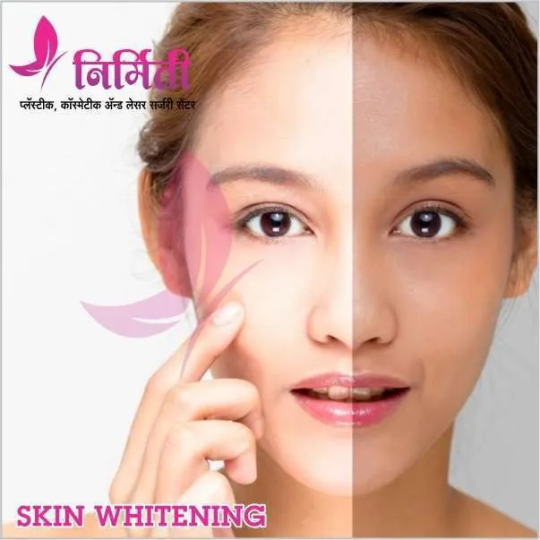 /img/32713-skin-whitening-cochin-7.webp