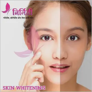 /img/32713-skin-whitening-cochin-7.webp