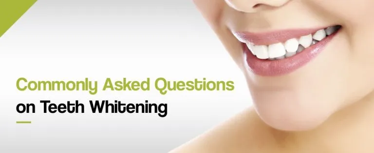 32740 teeth whitening lincoln ne options