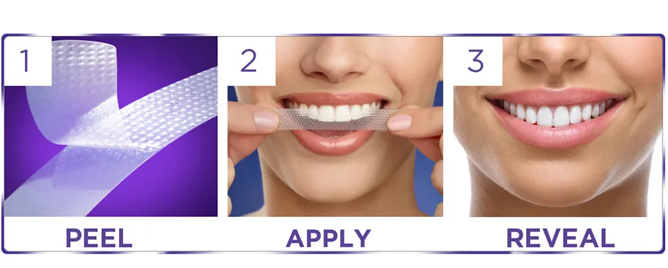 /img/32751-teeth-whitening-timeline.webp
