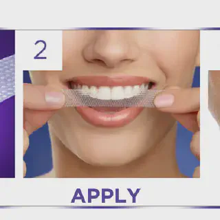 /img/32751-teeth-whitening-timeline.webp