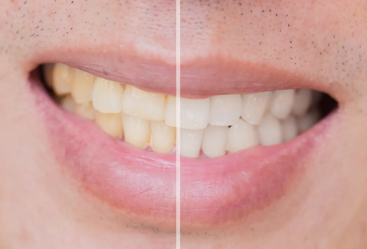 32762 oral hygiene routine