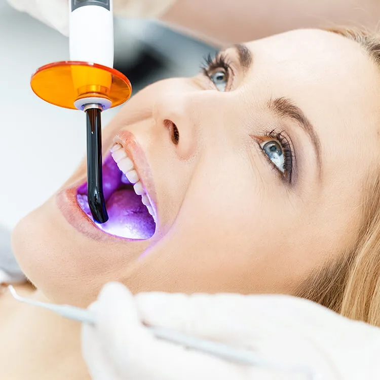 32762 professional teeth whitening