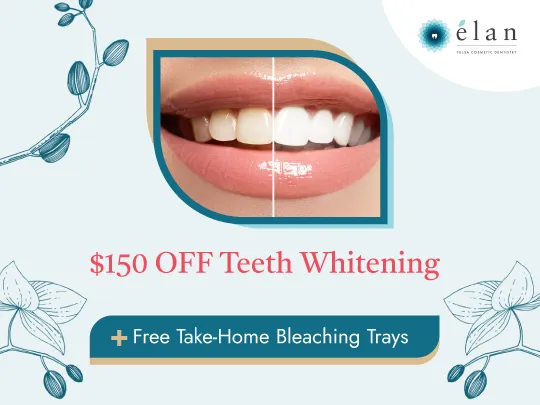 32763 teeth whitening cost factors
