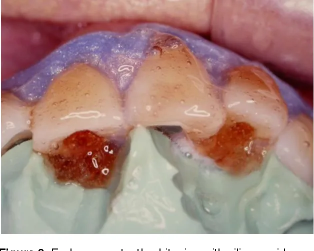 32767 teeth whitening maintenance