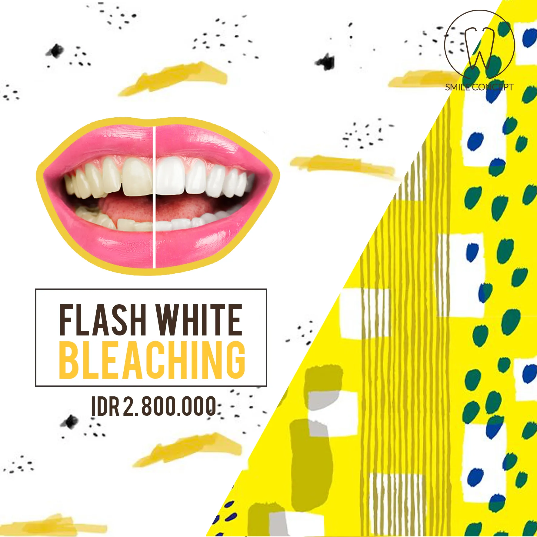 32770 in office teeth whitening