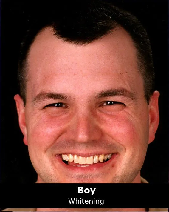 32770 professional teeth cleaning