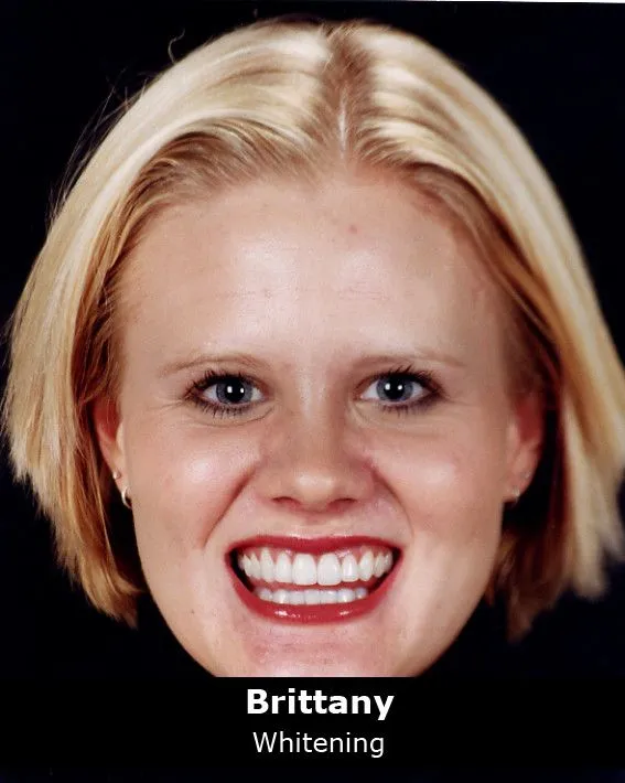 32770 whitening toothpaste