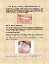 32773 westwood professional whitening