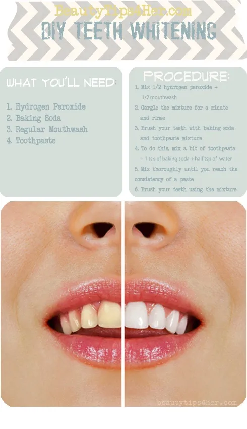 32783 teeth whitening homemade paste before after