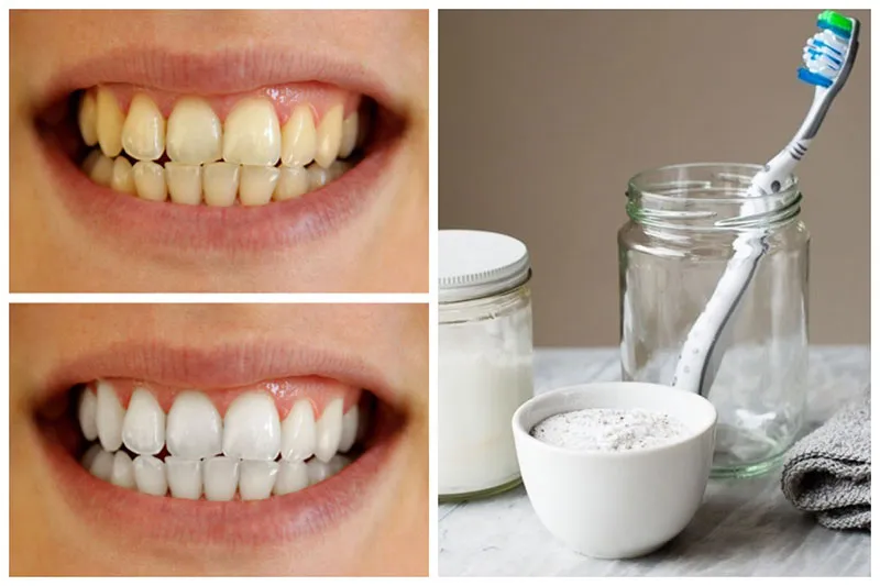 32783 teeth whitening homemade paste ingredients