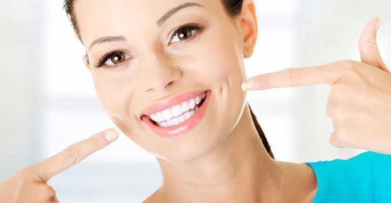 32785 professional teeth whitening