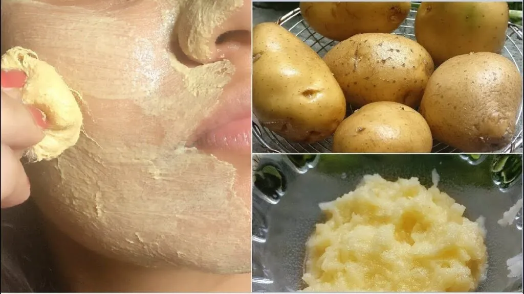 32786 acne treatment potato