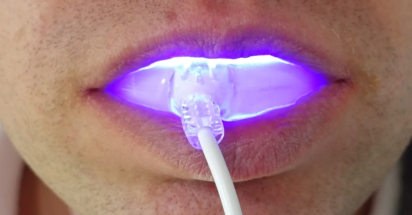 32795 teeth whitening process