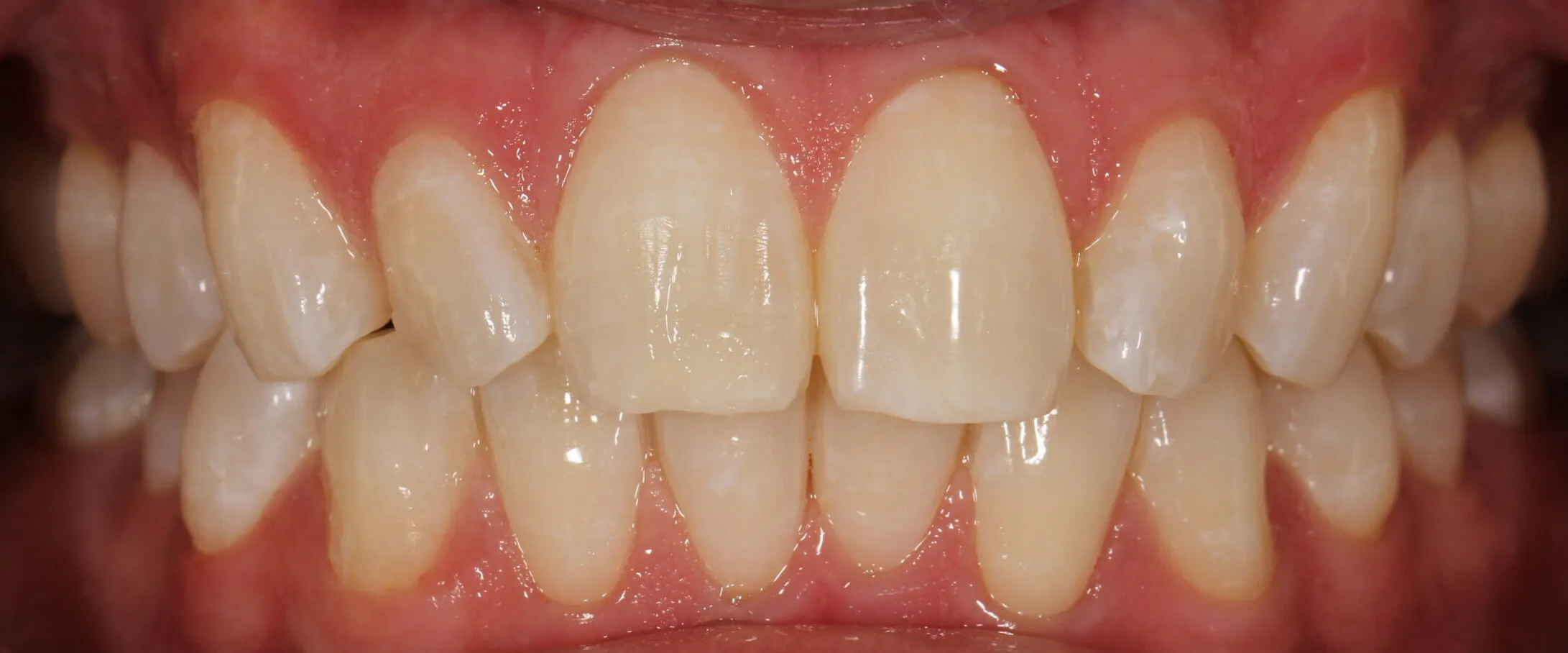 32803 whitening agents