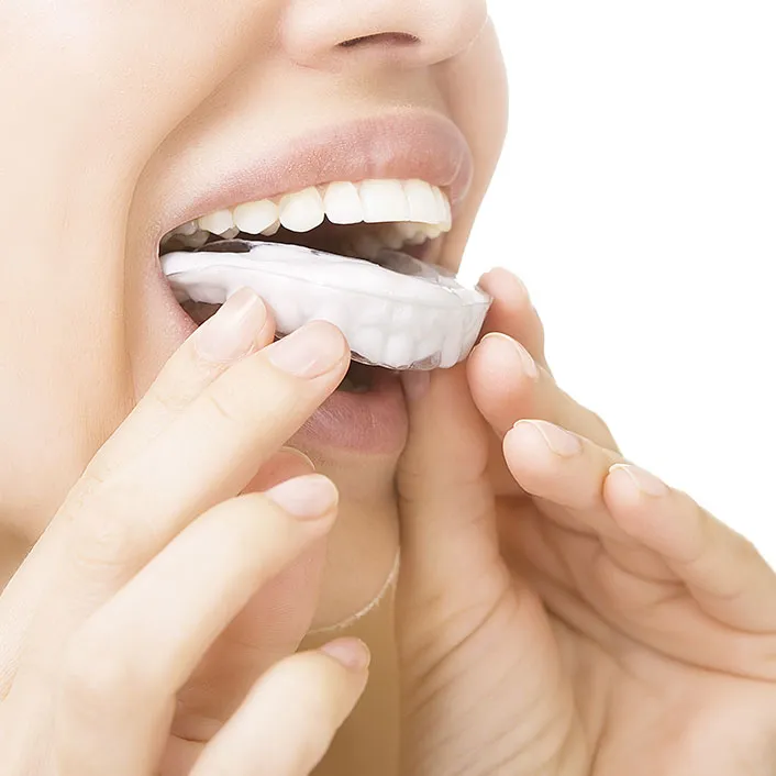 32804 applying whitening gel