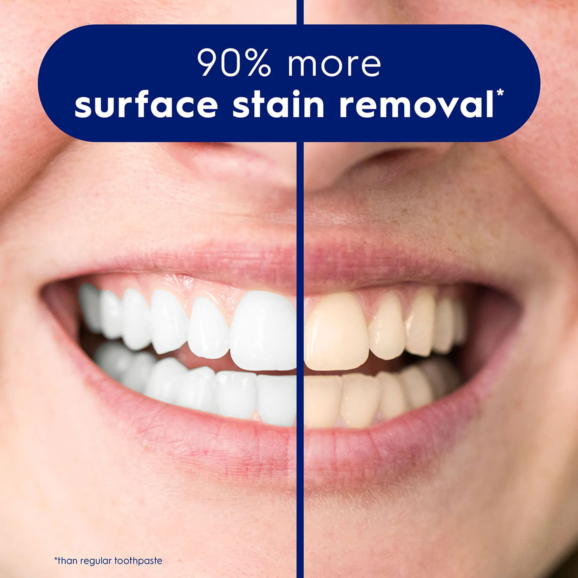 32813 benefits of whitening toothpaste