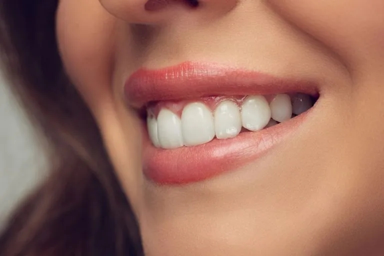 32816 teeth whitening mistakes 4
