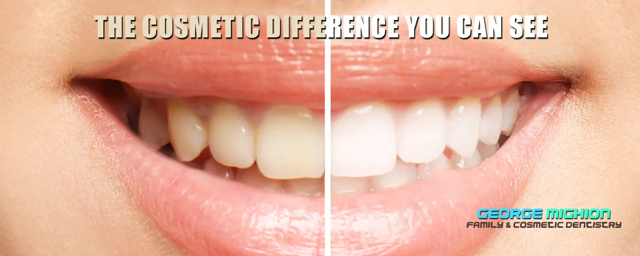 32817 teeth whitening professional