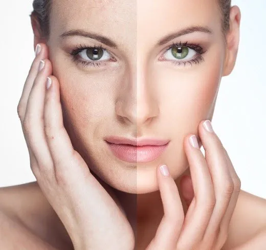 32833 lemon juice face