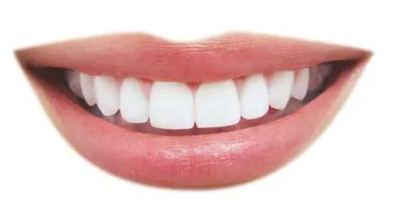 32836 teeth whitening turlock ca image4