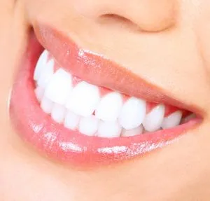32837 in office teeth whitening