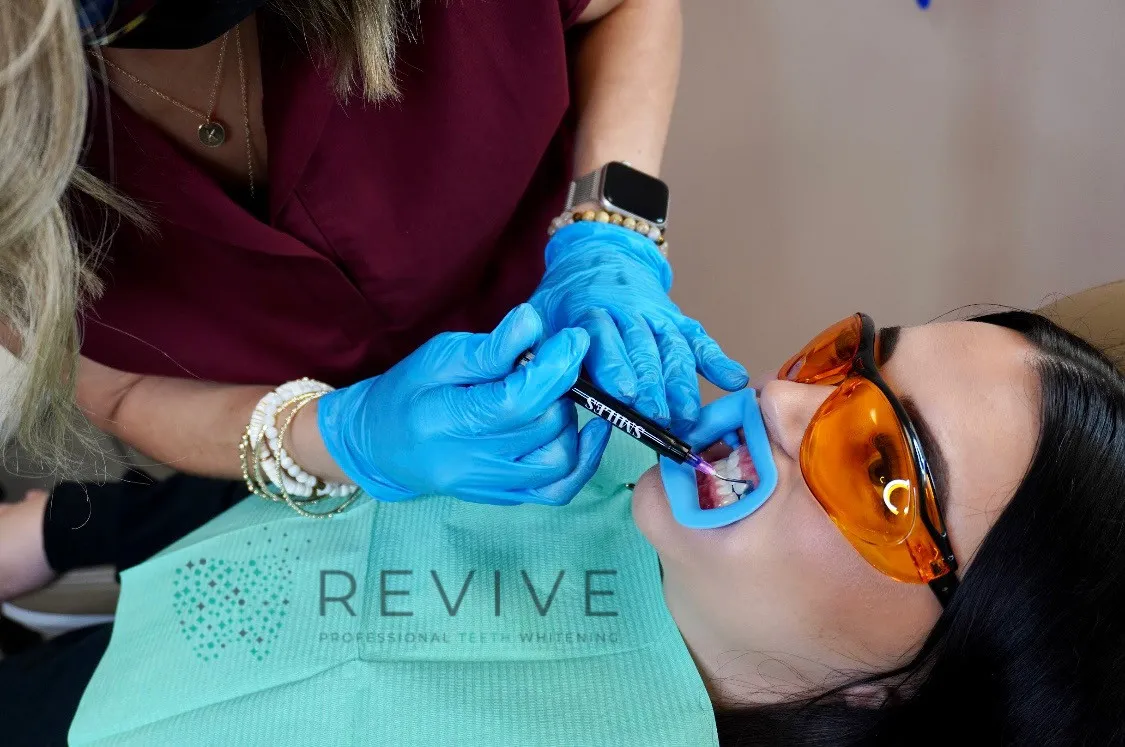 32837 types teeth whitening