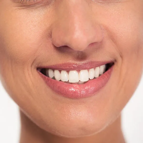 32841 at home teeth whitening kit