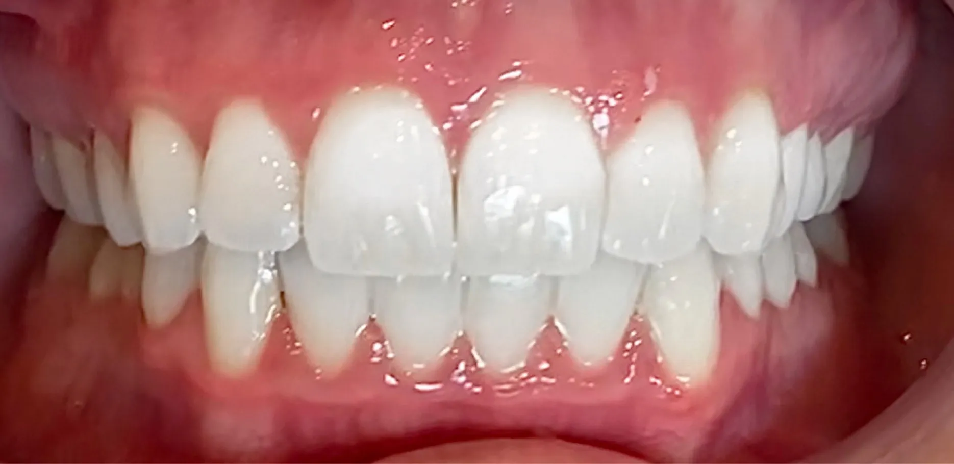 /img/32849-teeth-whitening-products.webp