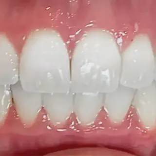 /img/32849-teeth-whitening-products.webp