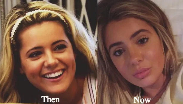 32876 healthy diet teeth