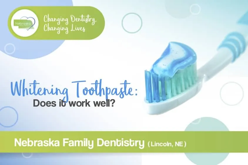 32891 at home teeth whitening kits