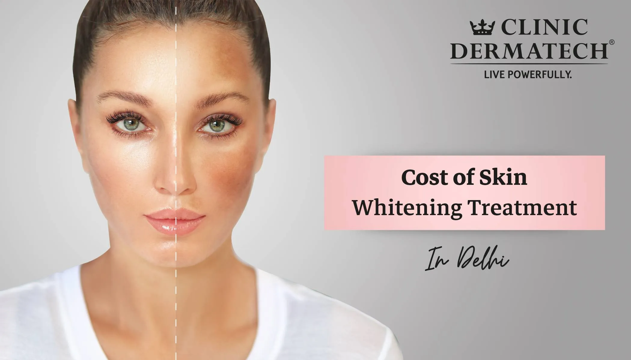 32897 skin whitening delhi 2
