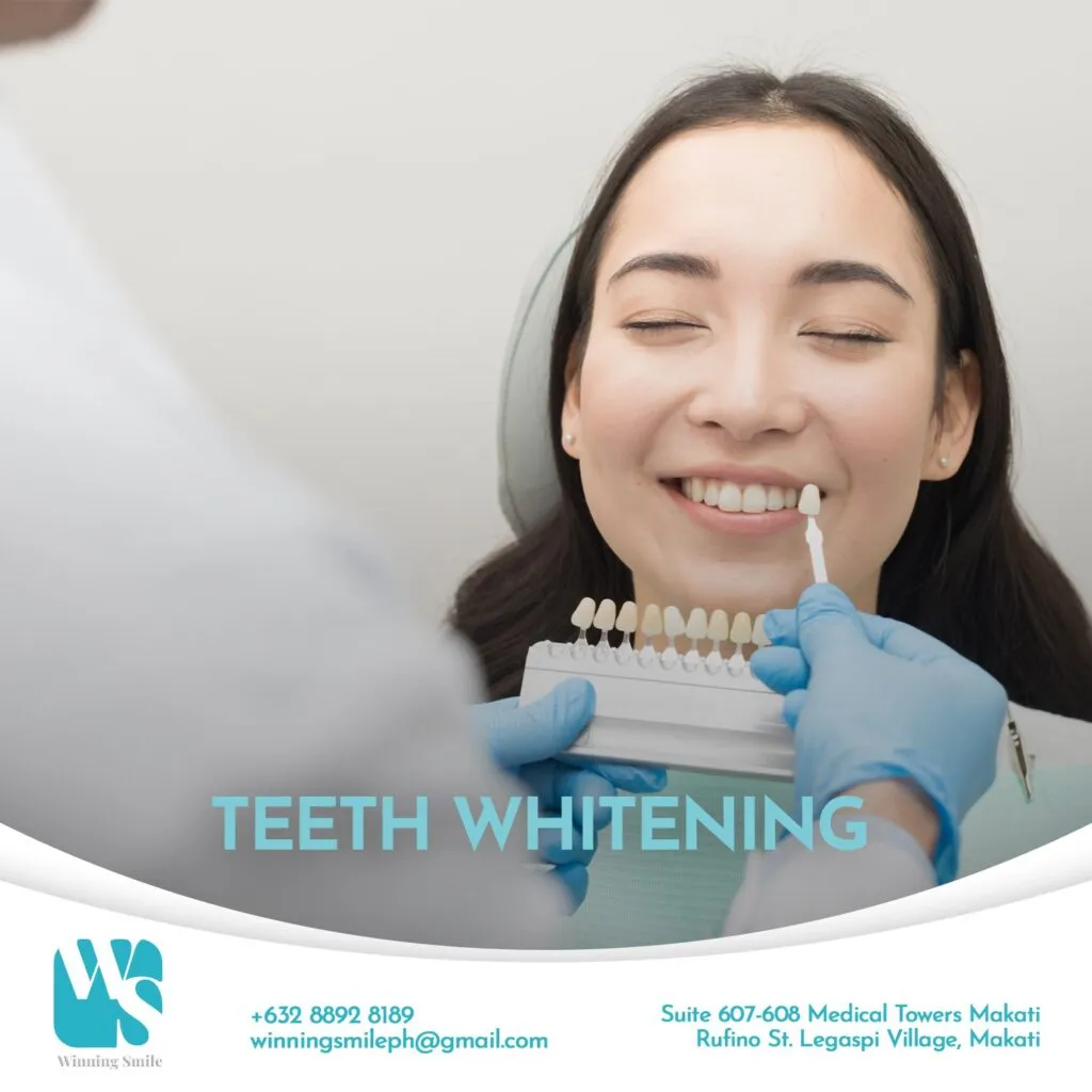 /img/32902-teeth-whitening-aftercare.webp