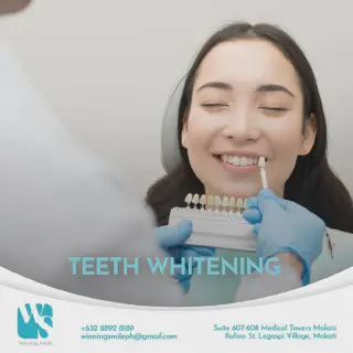 /img/32902-teeth-whitening-aftercare.webp