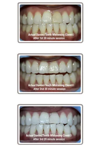 32907 dental checkup