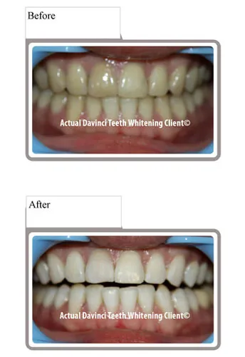 32907 whitening toothpaste