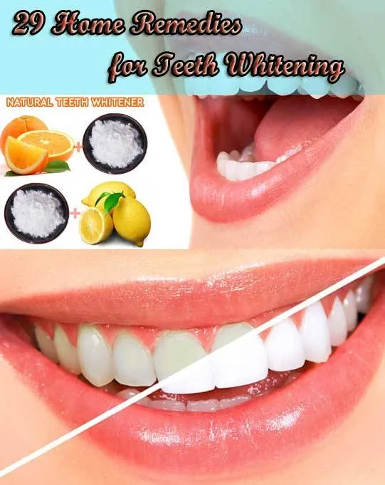 32910 teeth whitening safe