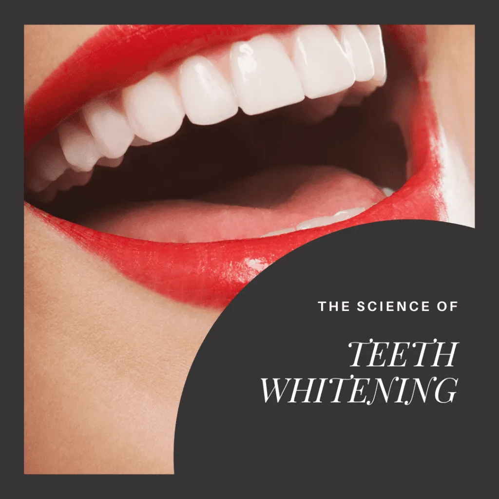 32915 at home teeth whitening