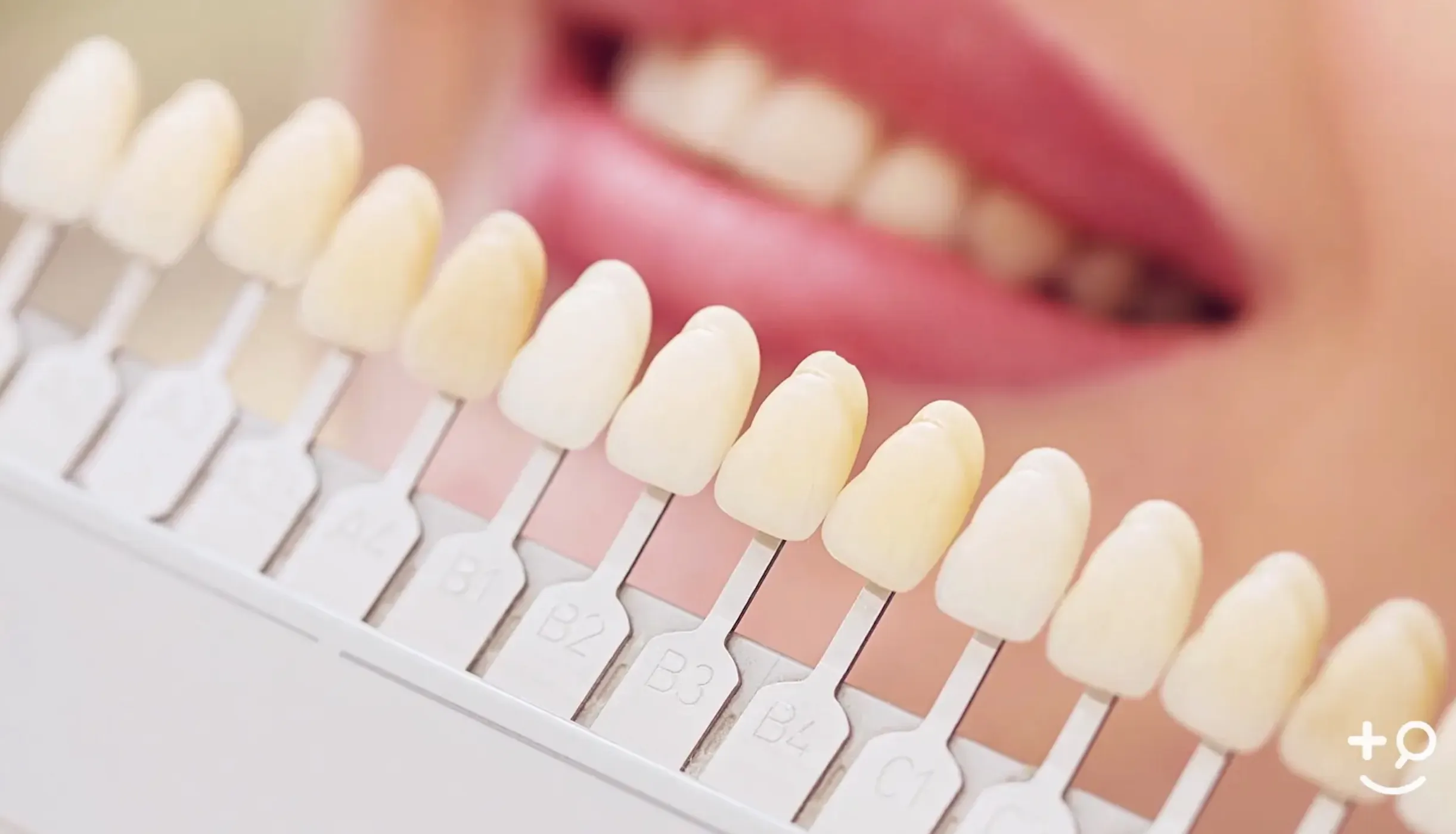 32915 in office teeth whitening